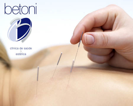 circuito chic; Clínica Betoni; Acumputura